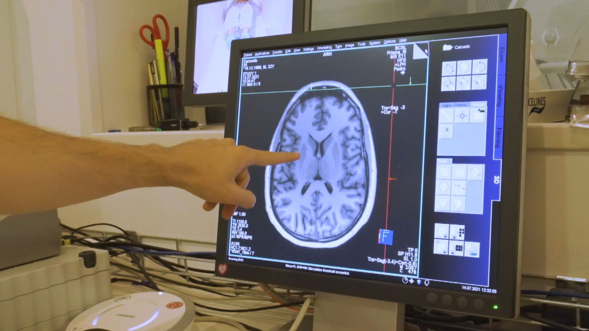 Imagen de nuestro cerebro en un experimento en el BCBL. Foto: EITB Media