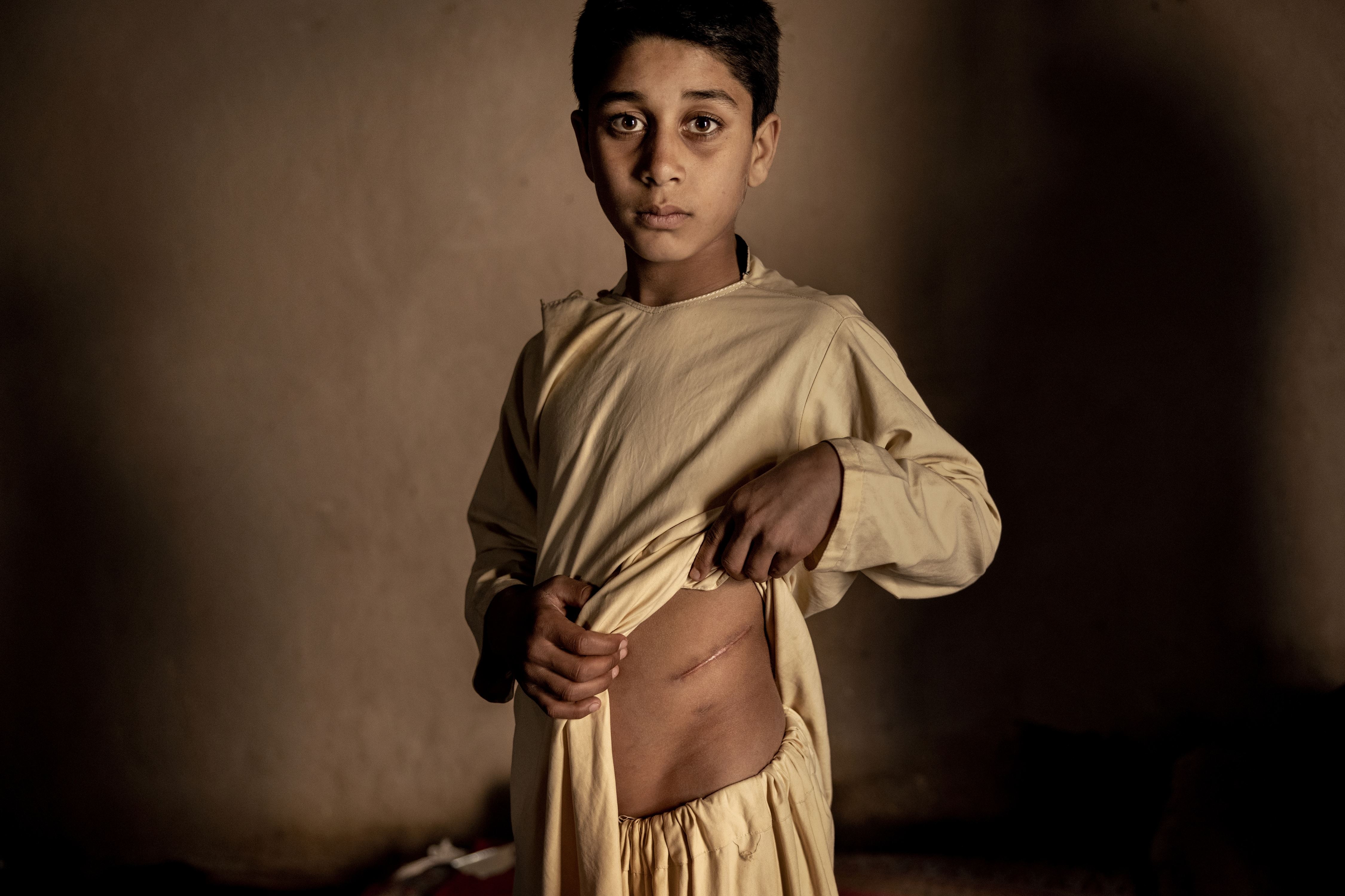 World Press Photo Story of the Year Foto: Mads Nissen