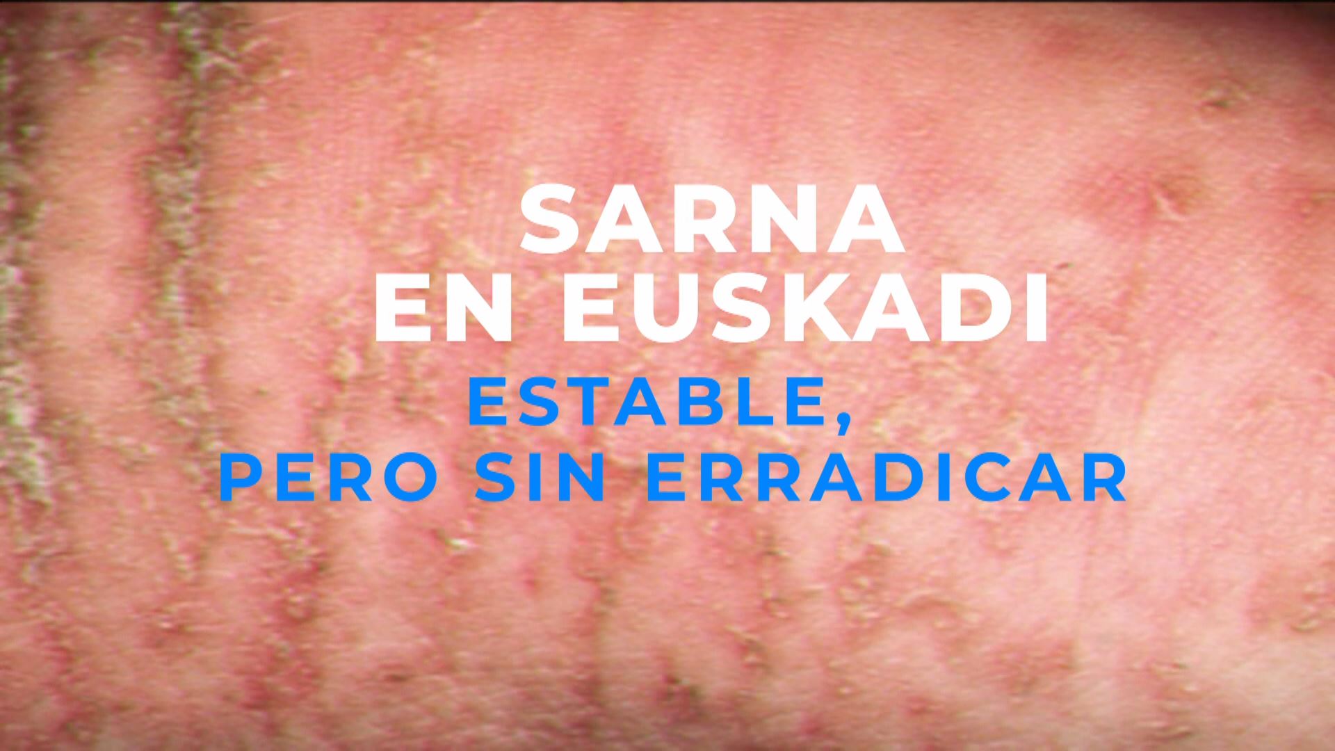 Los casos de sarna se mantienen estables